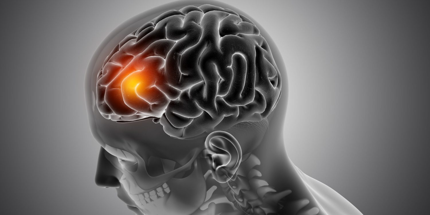 3D render of a male medical figure with front of the brain highlighted